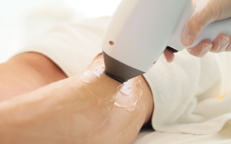 A gloved technician guiding a laser hair removal handpiece along a client's leg